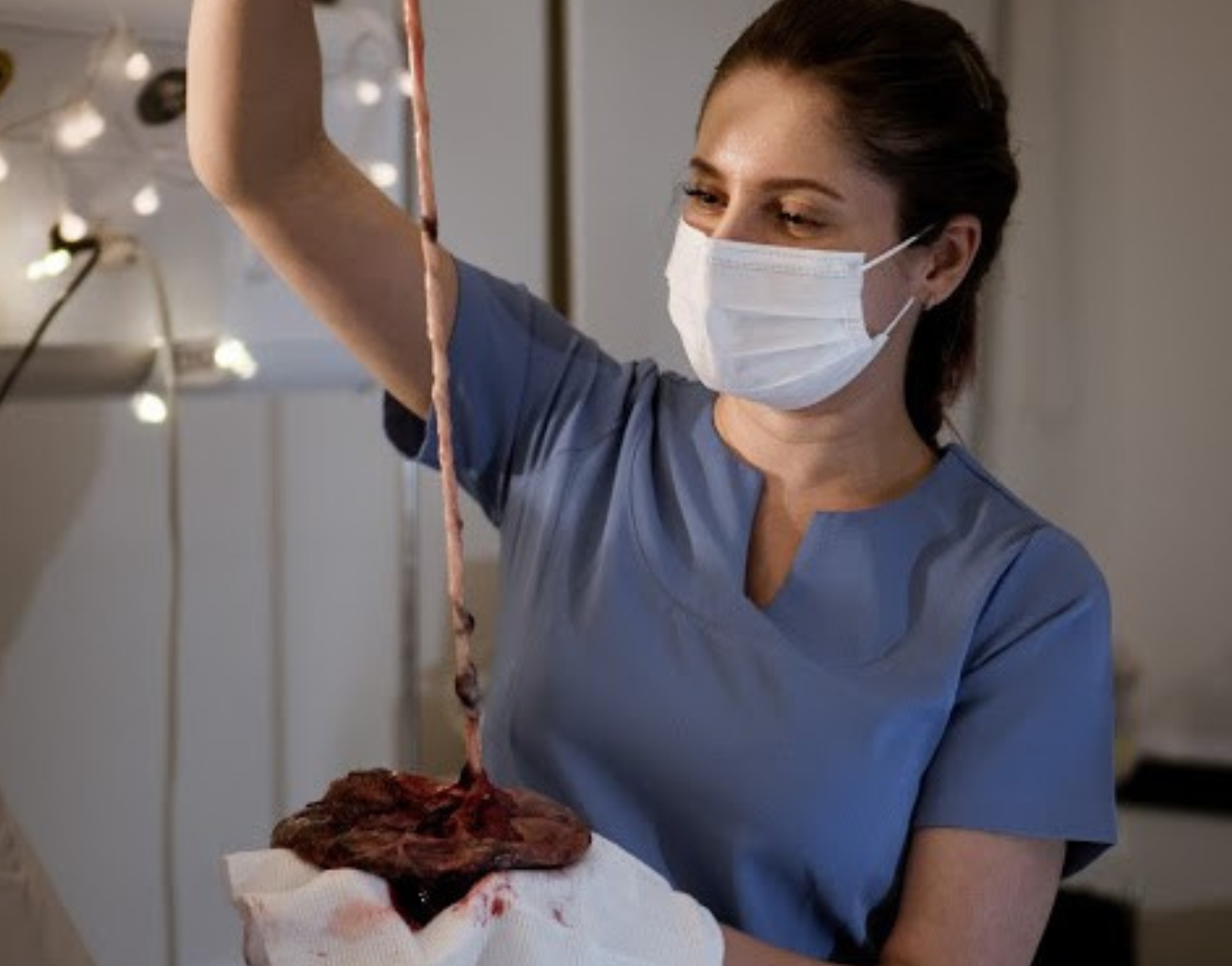 Carimbo de placenta